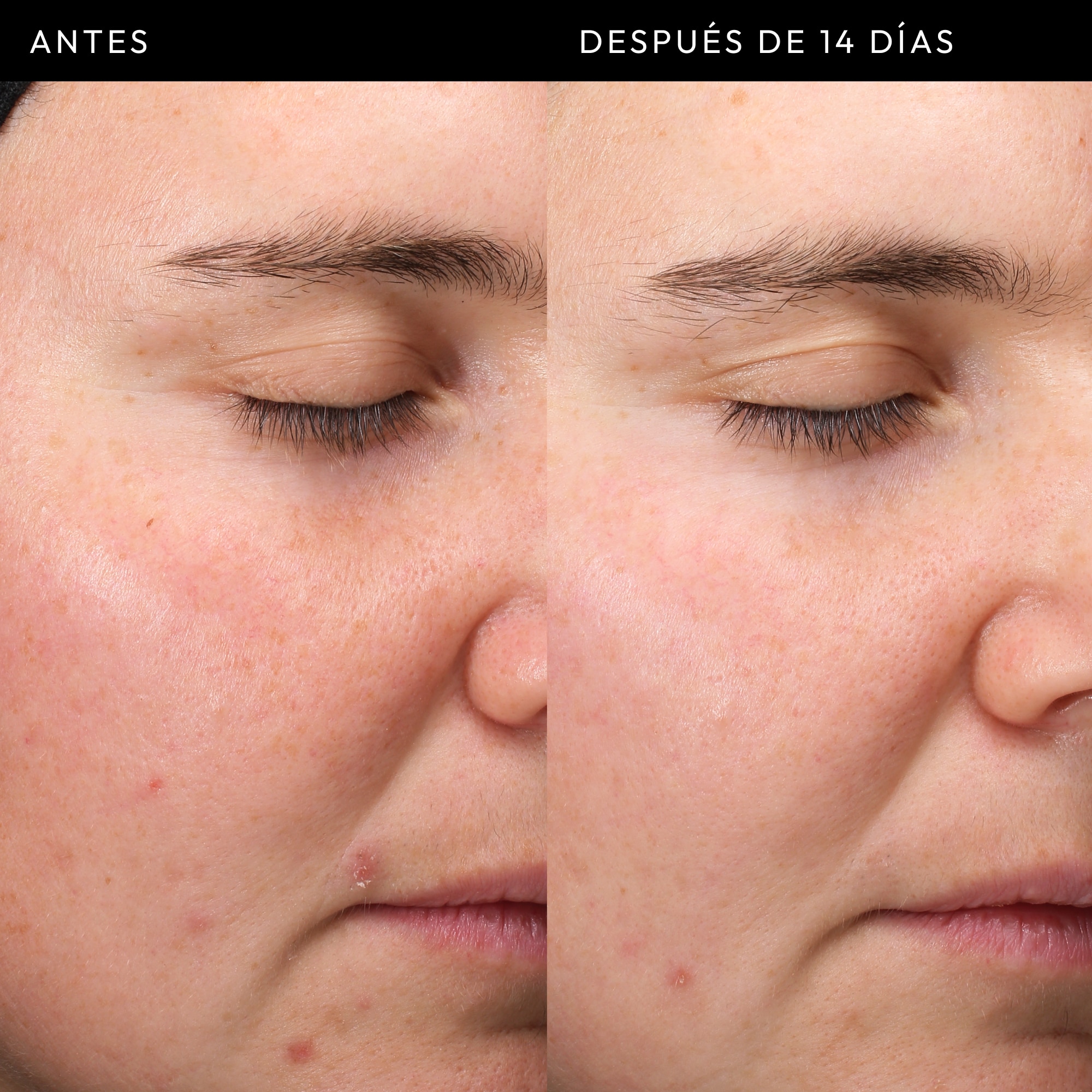 EXOSOME HYDRO-GLOW COMPLEX SERUM (SUERO PARA ROSTRO)